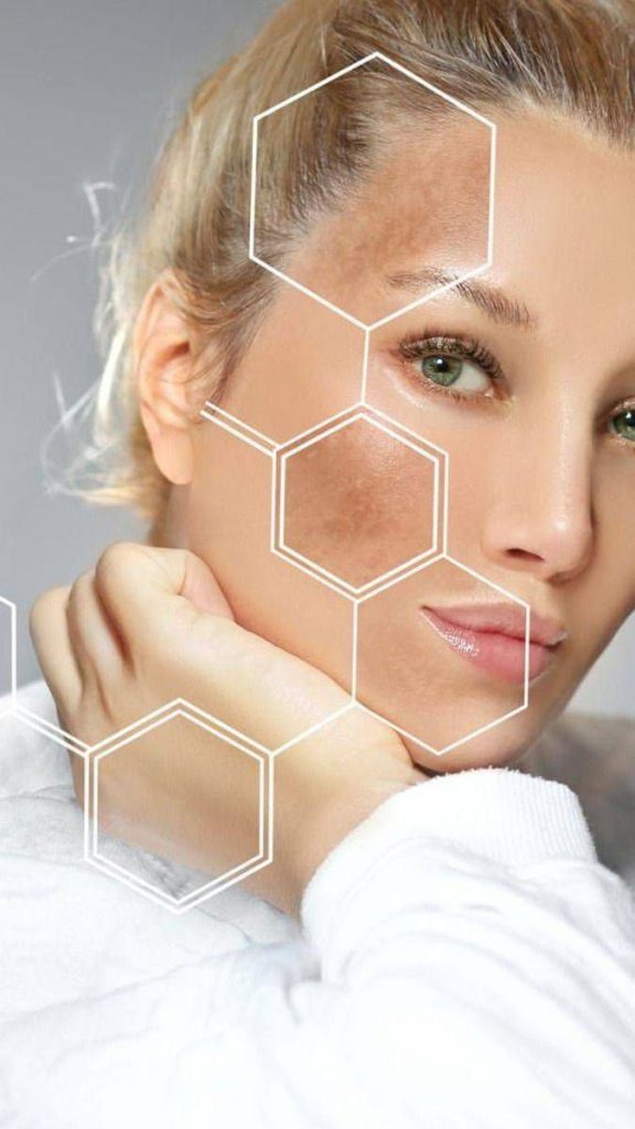 چگونه نوع پوست خود را شناسایی کنیم